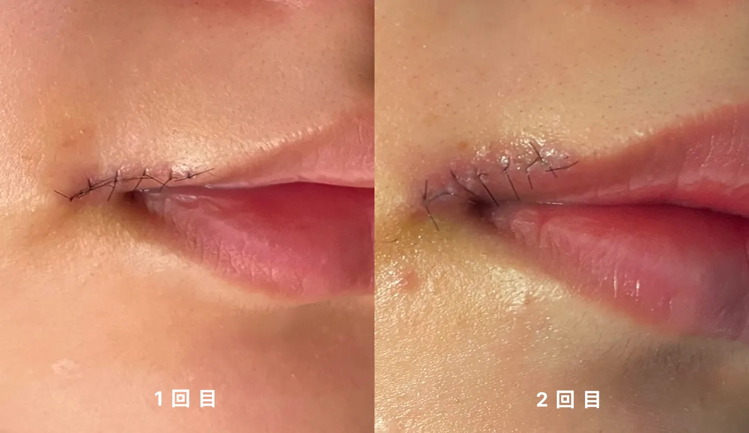 再手術で確信に変わった「シャドウドクター」
